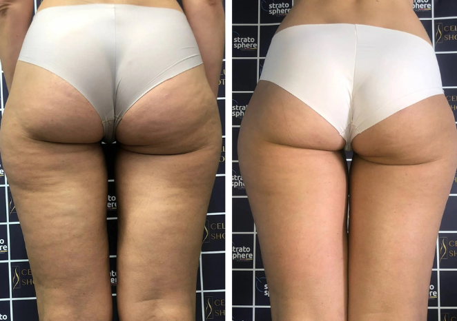 stratosfera mypilates